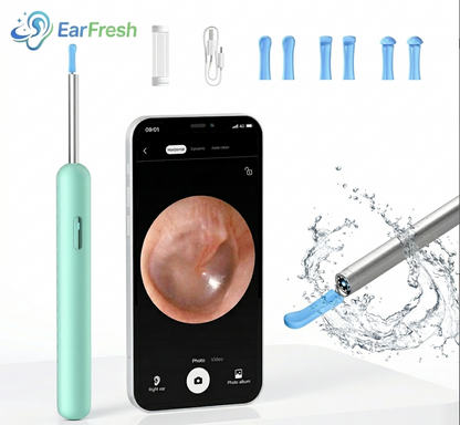 Visual Earpick Endoscope: Herramientas Inteligentes de Limpieza de Oídos con WiFi