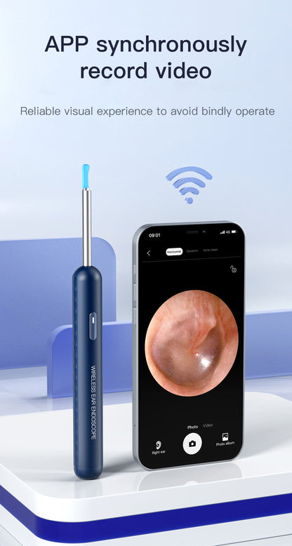 Visual Earpick Endoscope: Herramientas Inteligentes de Limpieza de Oídos con WiFi