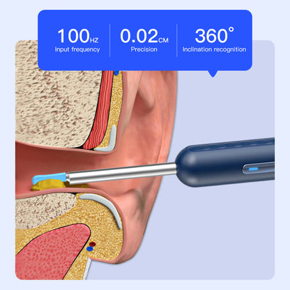 Visual Earpick Endoscope: Herramientas Inteligentes de Limpieza de Oídos con WiFi